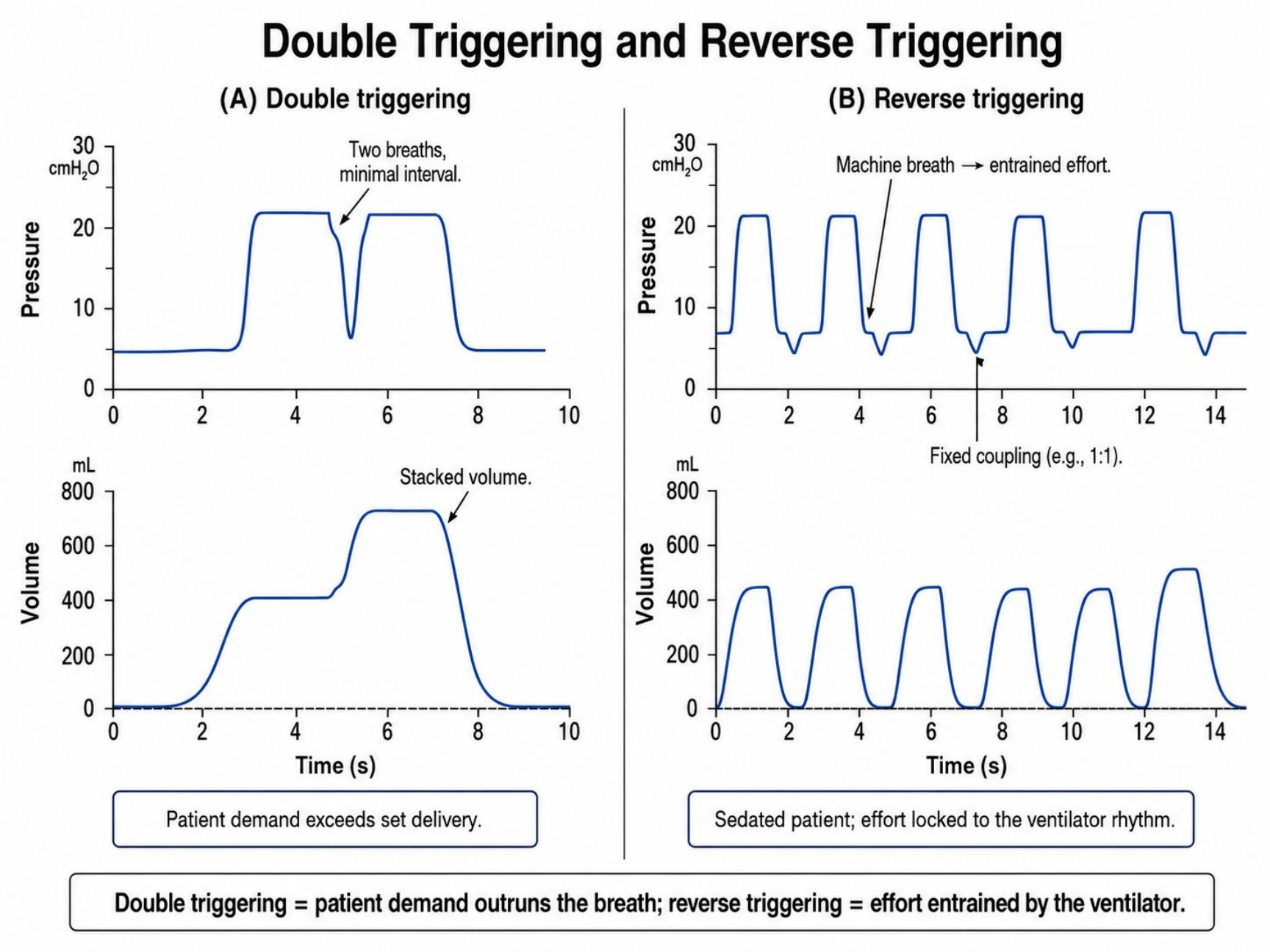 Hình MVG-F14-02. Kích hoạt kép, thể tích cộng dồn và reverse triggering. Nguồn: Mastering Ventilator Graphics, trang PDF 78.
